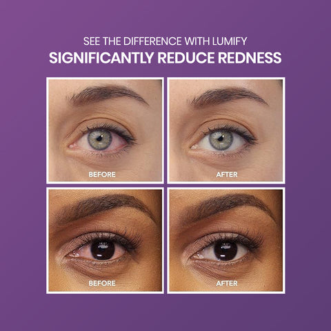 Four close-up eye images on a purple background illustrate the impact of Bausch & Lombs Lumify Redness Reliever Twin Pack (7.5mL x 2). The top eyes demonstrate enhanced whiteness after use, while the bottom pair shows similar before-and-after effects, highlighting Lumify’s impressive redness relief.