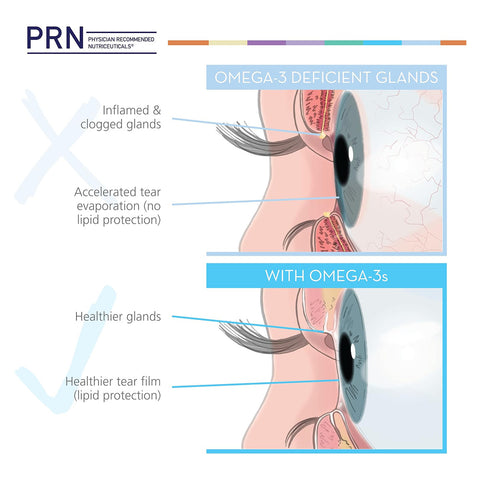 PRN Eye Omega Benefits for Kids Omega Benefits for Children’s Eyes (5oz)